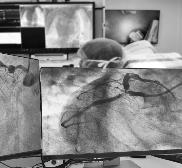 Coronary & Radial Angiography
